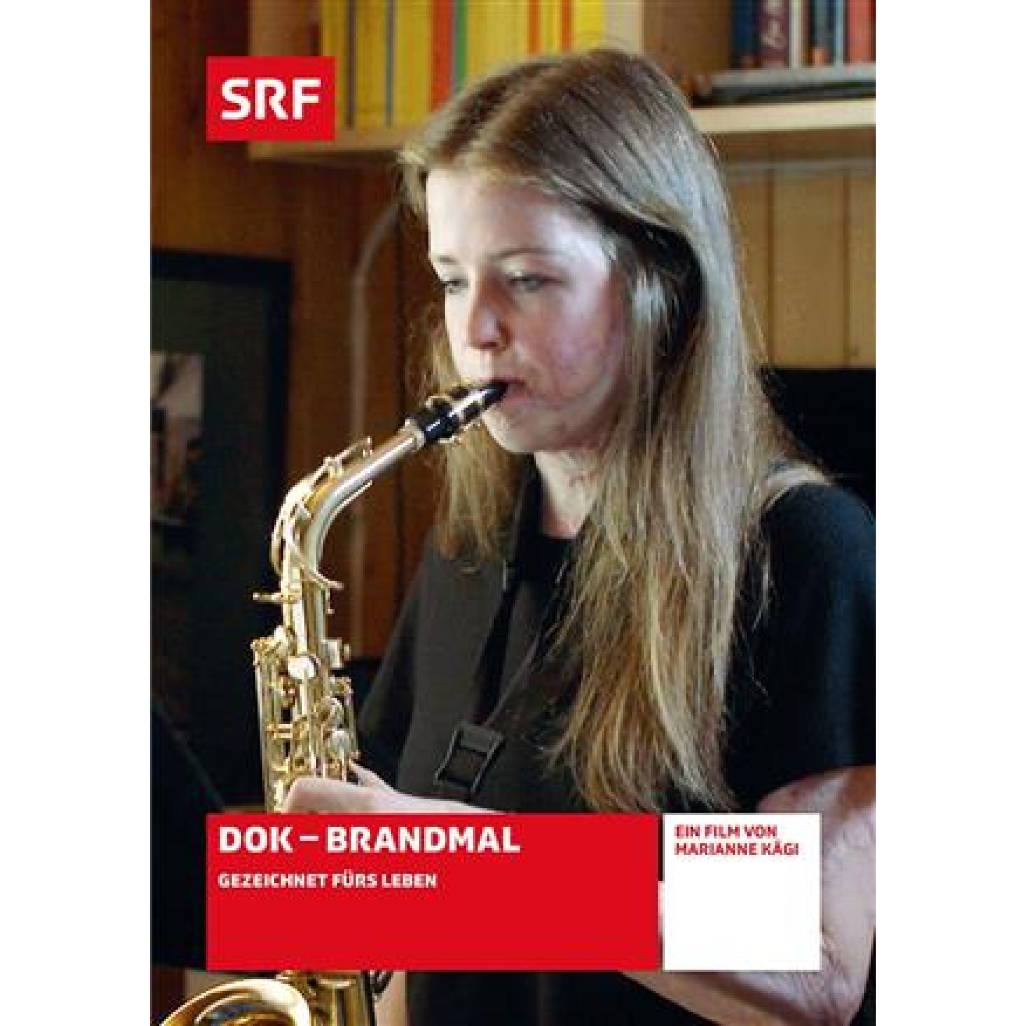 DVD Brandmal: Gezeichnet fürs Leben - SRF Doku DVD Brandmal: Gezeichnet fürs Leben - SRF Doku